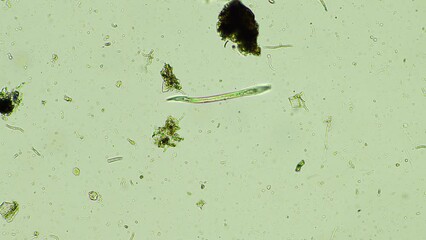 Wall Mural - Fungal and fungi hyphae under the microscope in the soil and compost, in a soil biology and microorganism test