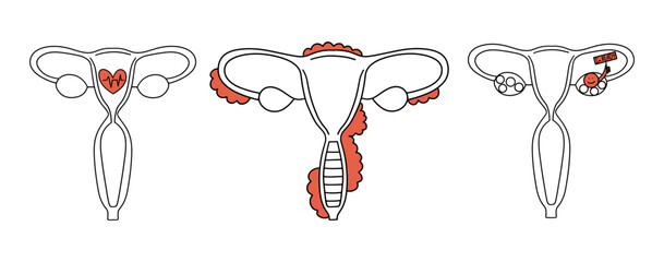 Female reproductive system symbol set. Uterus flat line art drawing with color spot. Women's health and gynecology concept. Ovulation and fertility contour icon. Outline vector illustration isolated