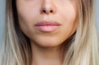 © Марина Демешко - Cropped shot of young caucasian blonde woman's face with perfect lips after lip enhancement. Injection of filler in lips on a gray background. The result of lip augmentation. Close up