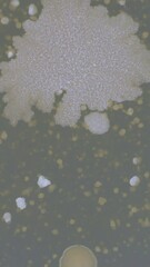 Poster - time lapse of growth of pathogenic bacteria on agar in a Petri dish