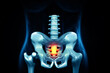 Human hip and pelvic pain, x-ray view, conditions, causes and treatment. 3d illustration