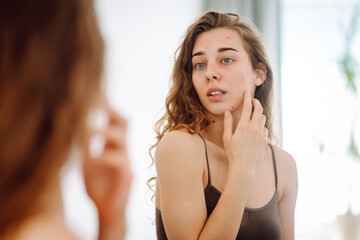 Portrait of a young woman touching a pimple on her face while looking in the mirror. Facial skin problems, medical care and treatment concept.