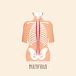 Multifidus muscle on human spine. Vector illustration.
