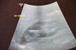 Right kidney in pelviabdominal ultrasonography reveals average size, shape, parenchymal thickness and echogenicity, no stones, no cysts or back pressure changes, right kidney is posterior to the liver