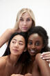 © master1305 - Portrait of beautiful, young asian, caucasian and african tender women with well-kept smooth skin standing against white background. Concept of multi ethnic beauty, spa, cosmetology, wellness, ad