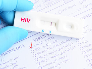 Wall Mural - HIV positive test result by using rapid test device