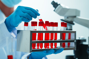 Close up dedicated hematology lab technician scrutinizing blood sample analysis under microscope, scientific laboratory research and drug testing concept, red color liquid