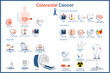 Flat style colorectal cancer infographic vector illustration.Symptoms,risk factors and causes,testing and diagnosis, prevention and treatment of colon cancer.