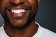 Happily smiling African American young man with perfectly white even teeth. Smiling mouth close up.