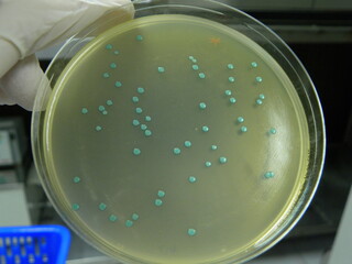 blue/green colonies of listeria on aloa agar plate, cultured by spread plate method.