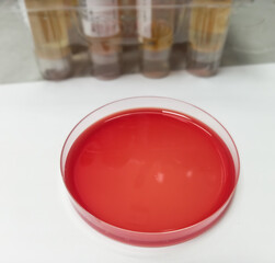 Poster - Blood agar plate use to culture fastidious bacteria.