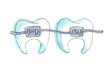 Watercolor line sketch of braces teeth. Hand-drawn illustration isolated on the white background
