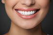 © Yuliya - Beautiful female smile after teeth whitening procedure. Dental care. The concept of dentistry. Beauty. Close-up, Macro