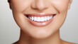 © StudioPixel2 - Young woman's smile. Beautiful white teeth. Dental care, dental concept.