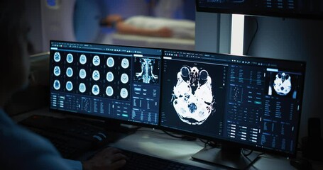 Aufkleber - Medical Hospital Research Lab: Male Medical Scientist Using Computer with Brain Scan MRI Images of a Female Patient Undergoing Medical Process in the Background. Healthcare Service