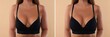 © New Africa - Woman before and after breast augmentation on beige background, closeup. Collage with photos showing difference between breast sizes