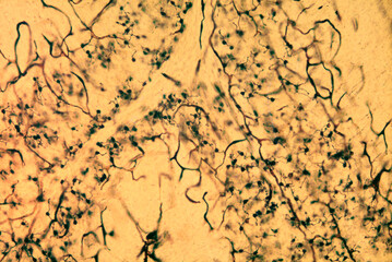 Wall Mural - Cerebellar cortex. Granular layer