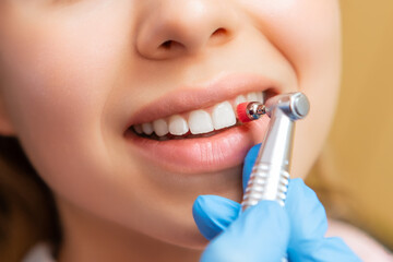 Wall Mural - Close-up dentist performing teeth grinding procedure in dental clinic. Woman visits doctor grinding teeth to create perfect smile in private hospital