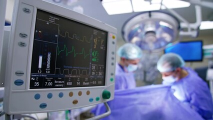 Black screen of a lung ventilator with running curves. Equipment monitoring the condition of patient under surgery. Doctors work at backdrop.