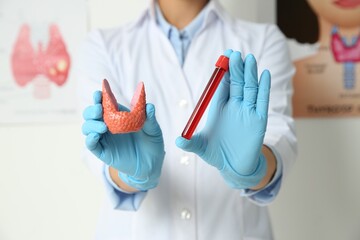 Endocrinologist showing thyroid gland model and blood sample in hospital, closeup