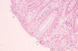 Histological Rectum human, Gall bladder human and Urethra Human under the microscope for education.