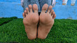 Peeling skin on dry feet on green grass