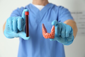 Endocrinologist showing thyroid gland model and blood sample in hospital, closeup