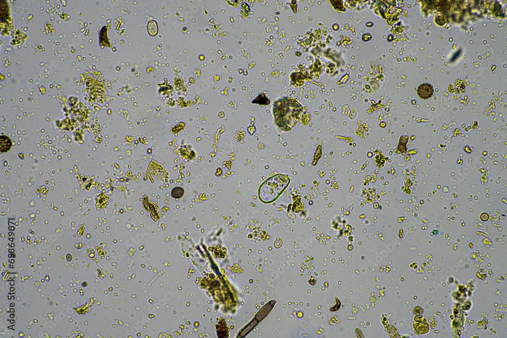 Microorganisms and biology in Compost and soil sample under the ...