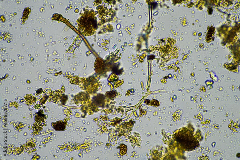 Microorganisms and biology in Compost and soil sample under the ...