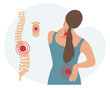 © Tatiana - Woman with pain in the cervical and lumbar vertebrae. Back pain, muscle pain, osteoarthritis, rheumatoid arthritis. Medicine. Illustration, vector