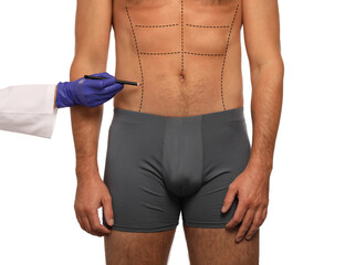 Poster - Man preparing for cosmetic surgery, white background. Doctor drawing markings on his abdomen, closeup