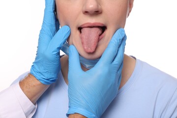 Canvas Print - Doctor examining woman`s oral cavity on white background, closeup