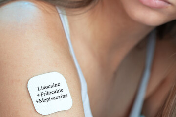 Lidocaine+Prilocaine+Mepivacaine Transdermal Patch