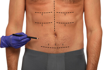 Sticker - Man preparing for cosmetic surgery, white background. Doctor drawing markings on his abdomen, closeup