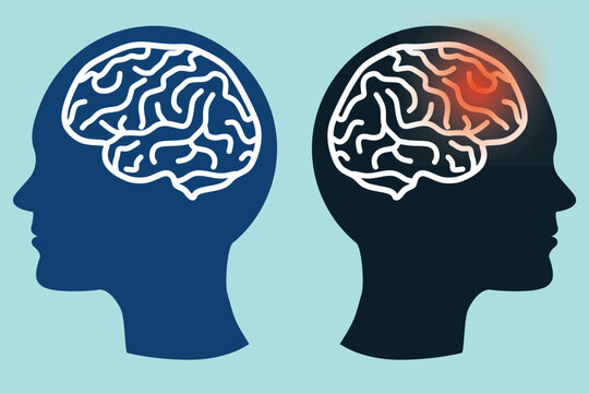 sick brain vs healthy brain