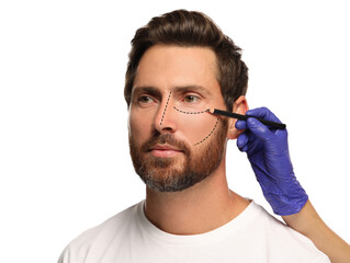 Poster - Man preparing for cosmetic surgery, white background. Doctor drawing markings on his face, closeup