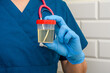 Lekarz trzyma w dłoni pojemnik z moczem przyniesiony do badania