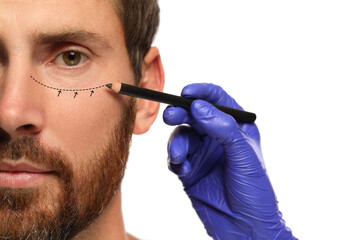 Poster - Man preparing for cosmetic surgery, white background. Doctor drawing markings on his face, closeup