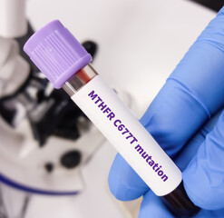 Poster - Blood sample for Methylenetetrahydrofolate Reductase (MTHFR) variant or MTHFR mutation test, to Hyperhomocysteinemia.