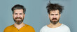 © Volodymyr - Man hair loss and problem hair. Hairs problems. Sad and happy. Haircare and loss hair problem. Tangling hairs. Combing damaged hairs. Beard and mustache. Hairstyle, hair stylist. Male beauty.