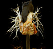CTA pulmonary artery  or CTPA with contrast media 3D rendering  normal pulmonary artery.