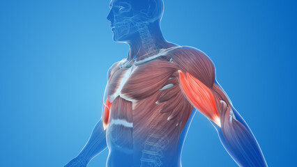 Wall Mural - Biceps muscle pain and injury