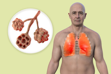 Canvas Print - A man with healthy lungs and close-up view of lung alveoli, 3D illustration