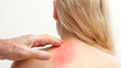 Man applying pain relieving cream, gel on woman's neck on white background. Pain relief and health care concept.