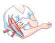 © VectorMine - Muscle weakness with weak and fatigue muscular system outline concept. Medical issue with physical disorder and arm cramps, exhaustion, pain or dystrophy vector illustration. Body atrophy problem.