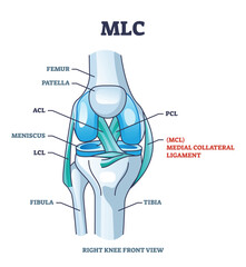 Sticker - MLC or medial collateral ligament anatomical location in knee outline diagram. Labeled educational leg skeletal system with bones and ligaments vector illustration. ACL, PCL and LCL medical study.