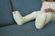 little child with plaster bandage on leg.