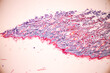 Characteristics Tissue of Human scalp, Skin human from general body surface and showing sweat glands under microscope.
