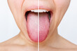 Female tongue with a white plaque. Comparison of a diseased tongue with a white plaque and a healthy clean tongue before and after treatment on a light background. The result of cleaning the tongue