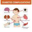 Diabetes complications with man symptom infographic cartoon illustration on white background